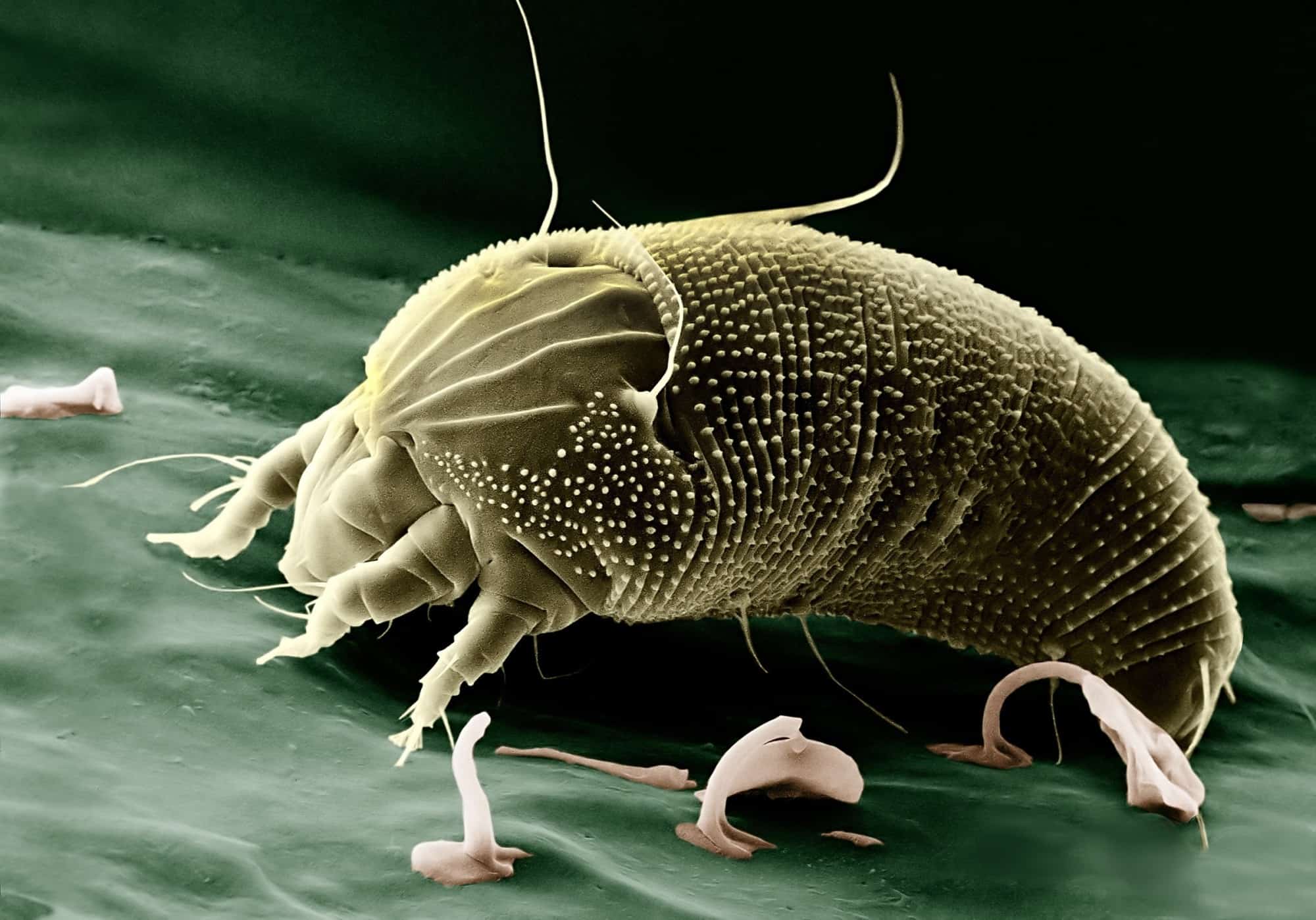 Microscopic view of a mite.