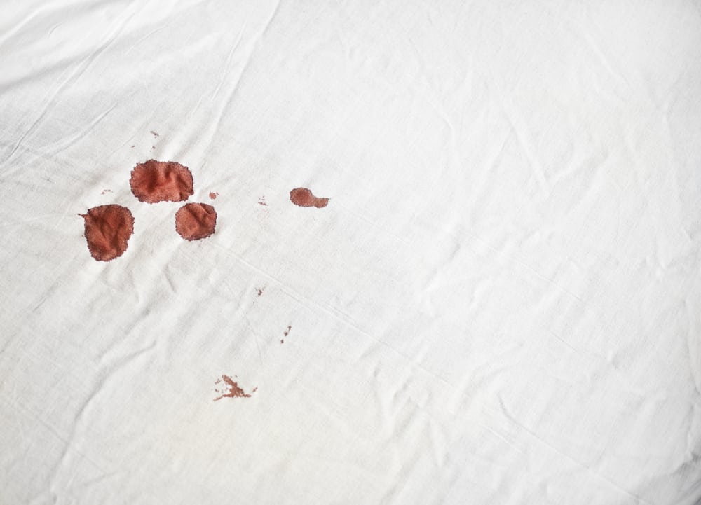 Removing blood from sheets