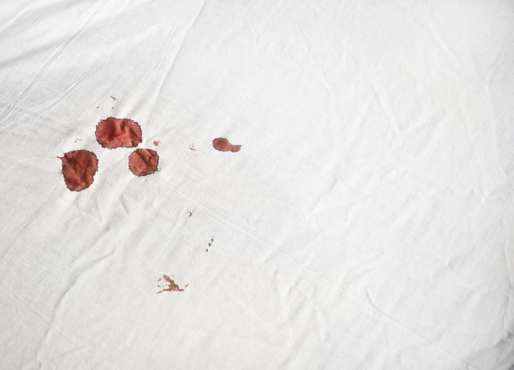 How to Remove Blood Stains from Bed Sheets - QuickZip Sheet